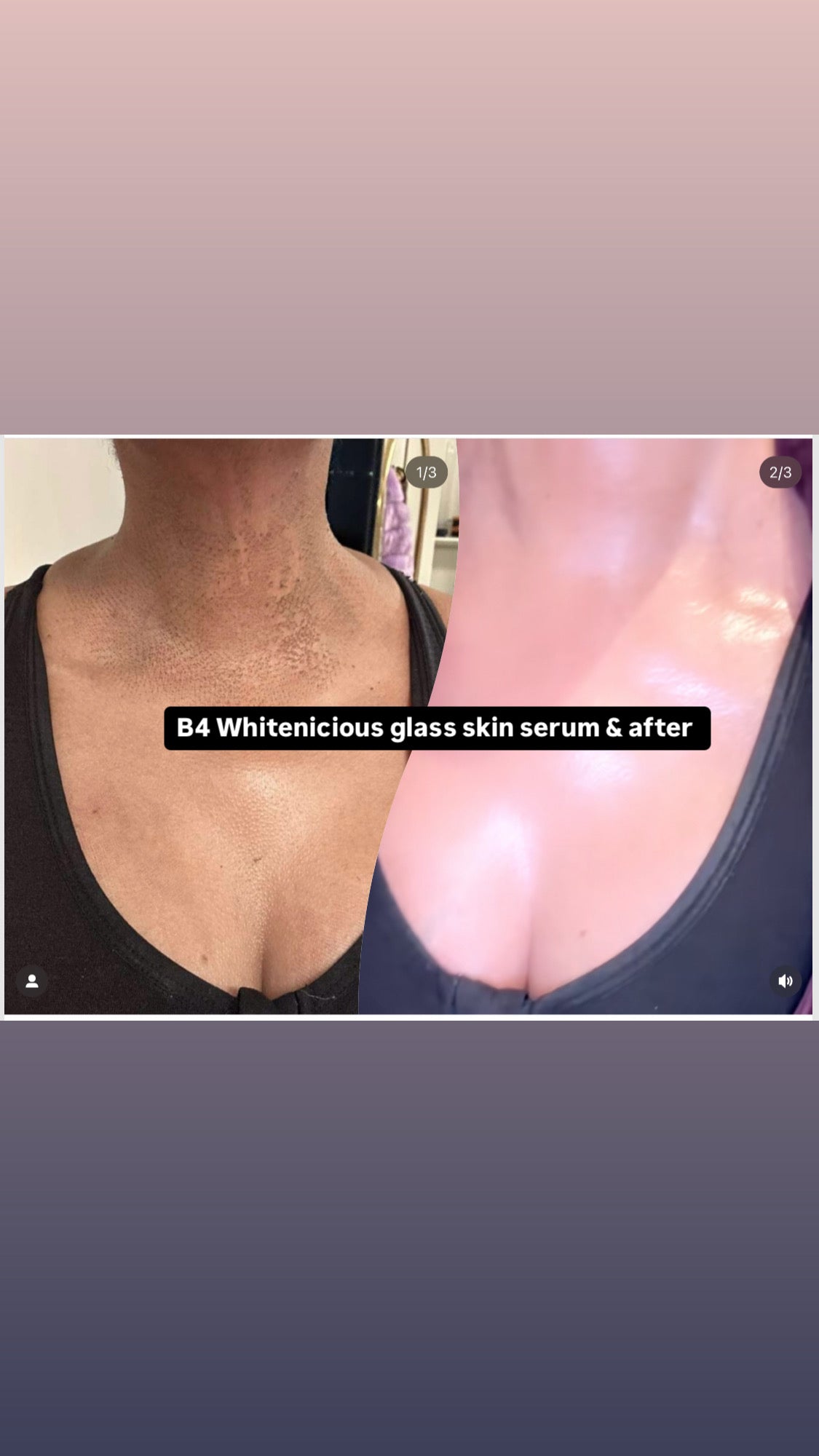 Skin healing & Beautifying Ointment (Glass Skin)"