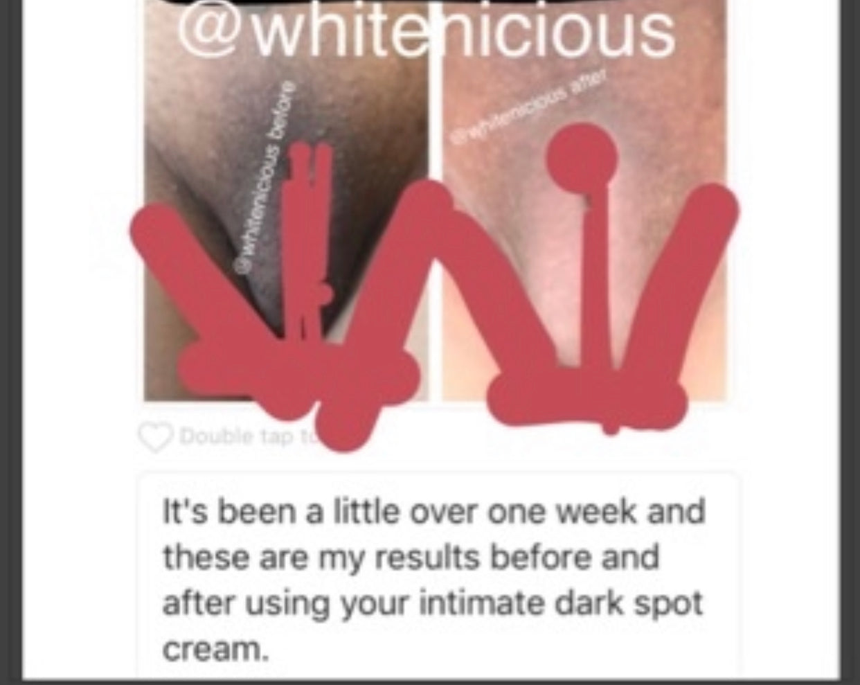 Intimate Areas Brightening Cream WBD 70Ml