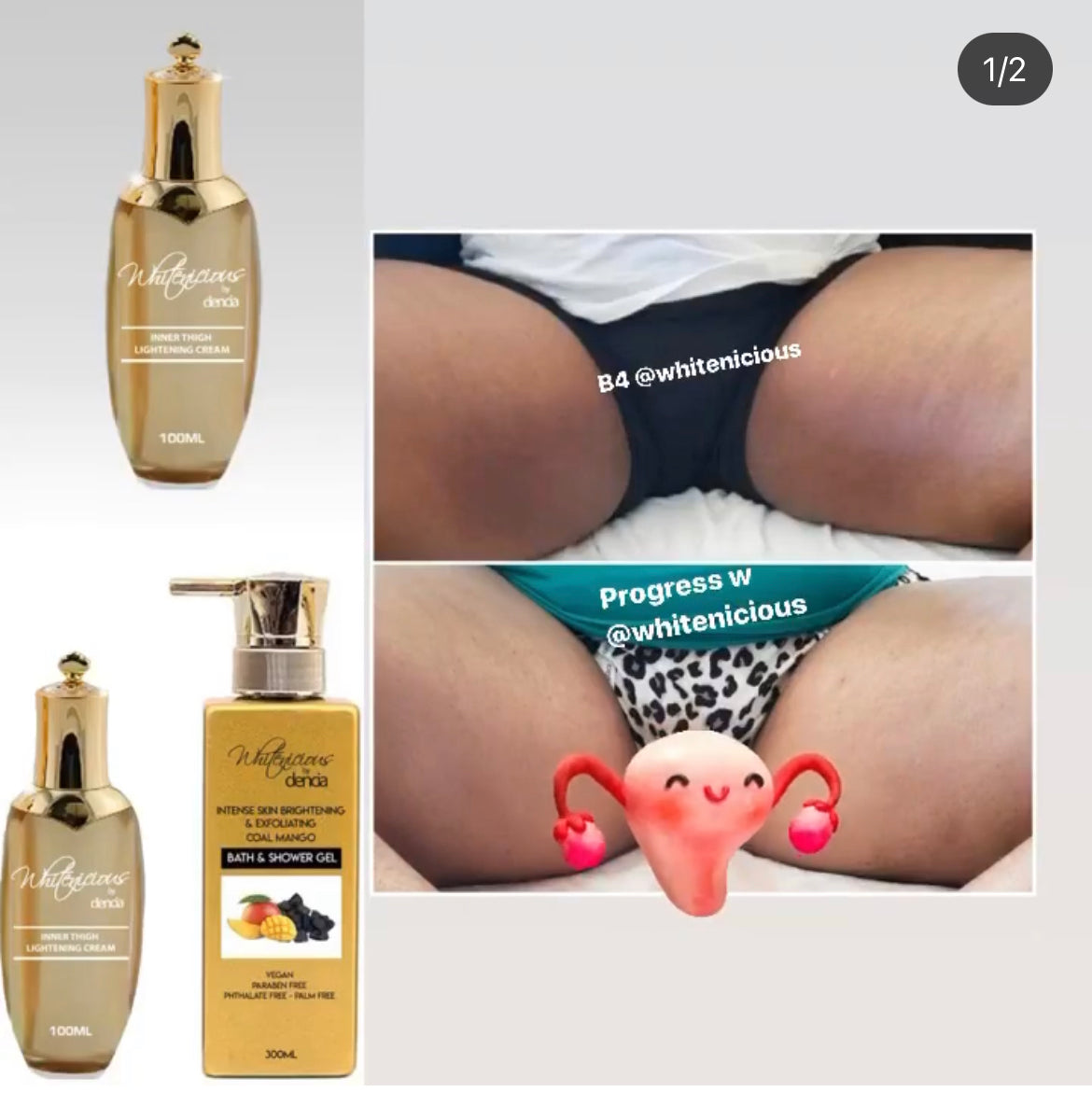 Buttocks & INNER THIGHS LIGHTENING
