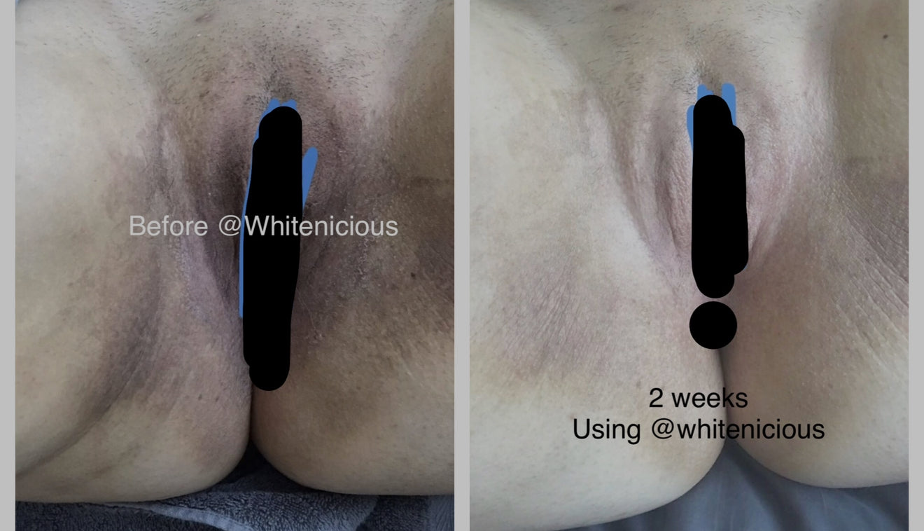 Intimate Area Cream 100Ml