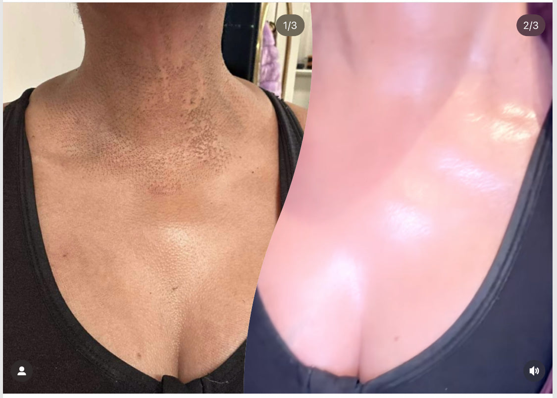 Dark Spot Face & Body Bleaching Cream Blac Chyna                                               60G