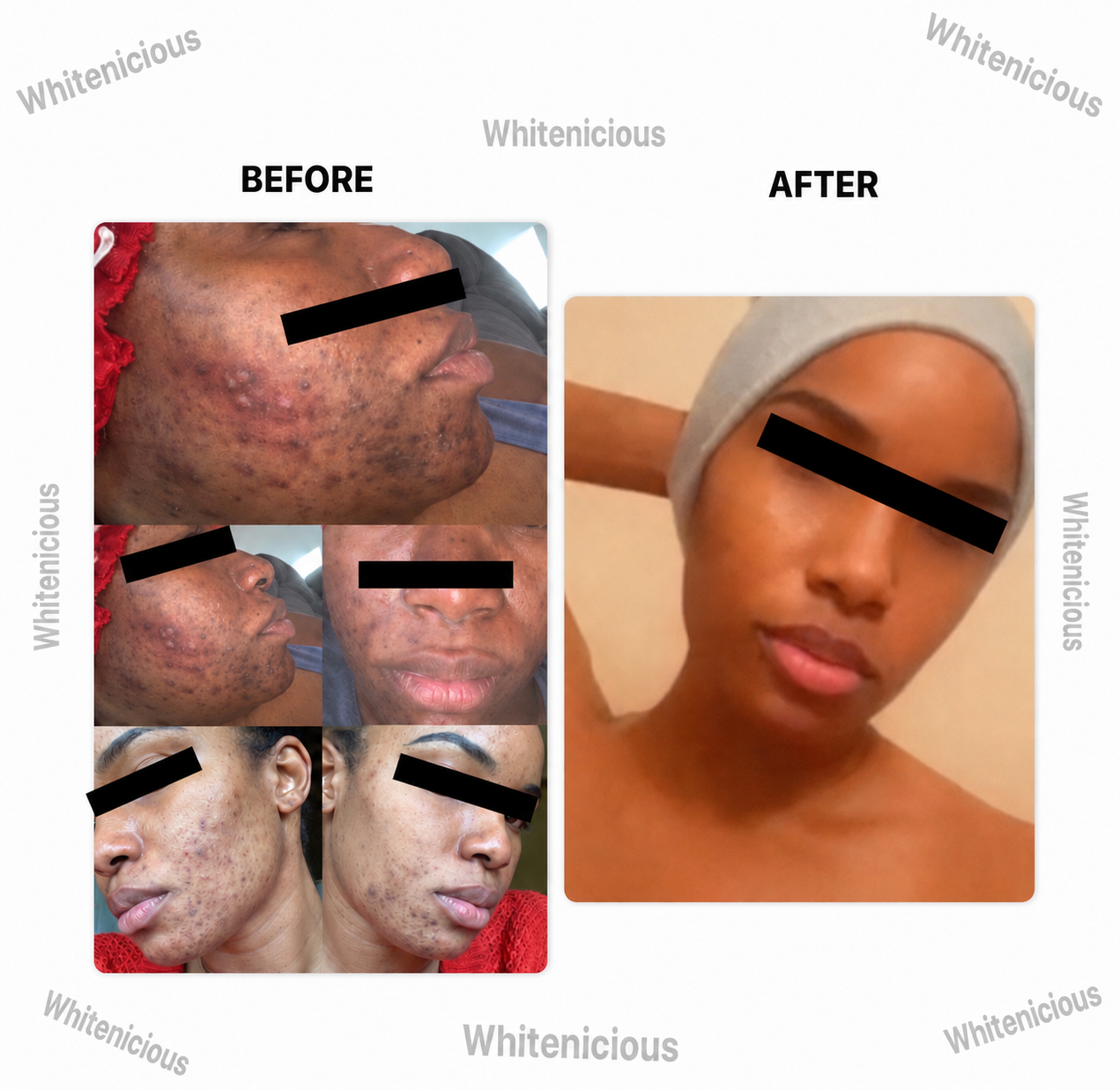24k Gold Infused DarkSpot  Eraser Crème