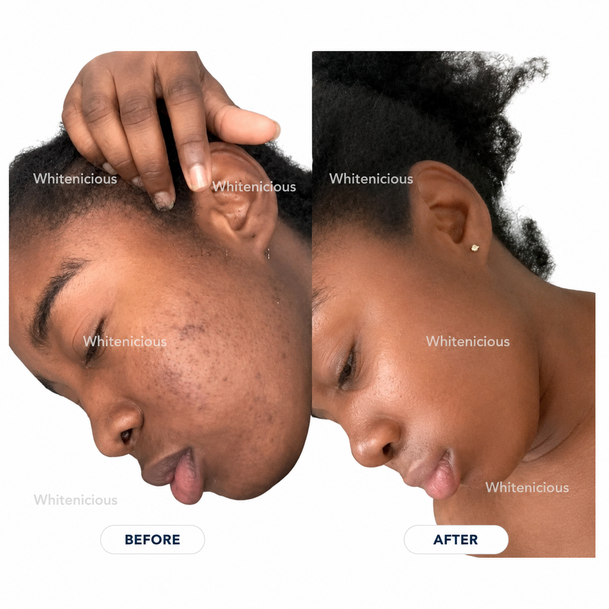 24k Gold Infused DarkSpot  Eraser Crème