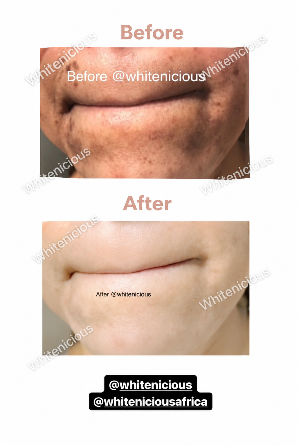 Angel Skin Creme