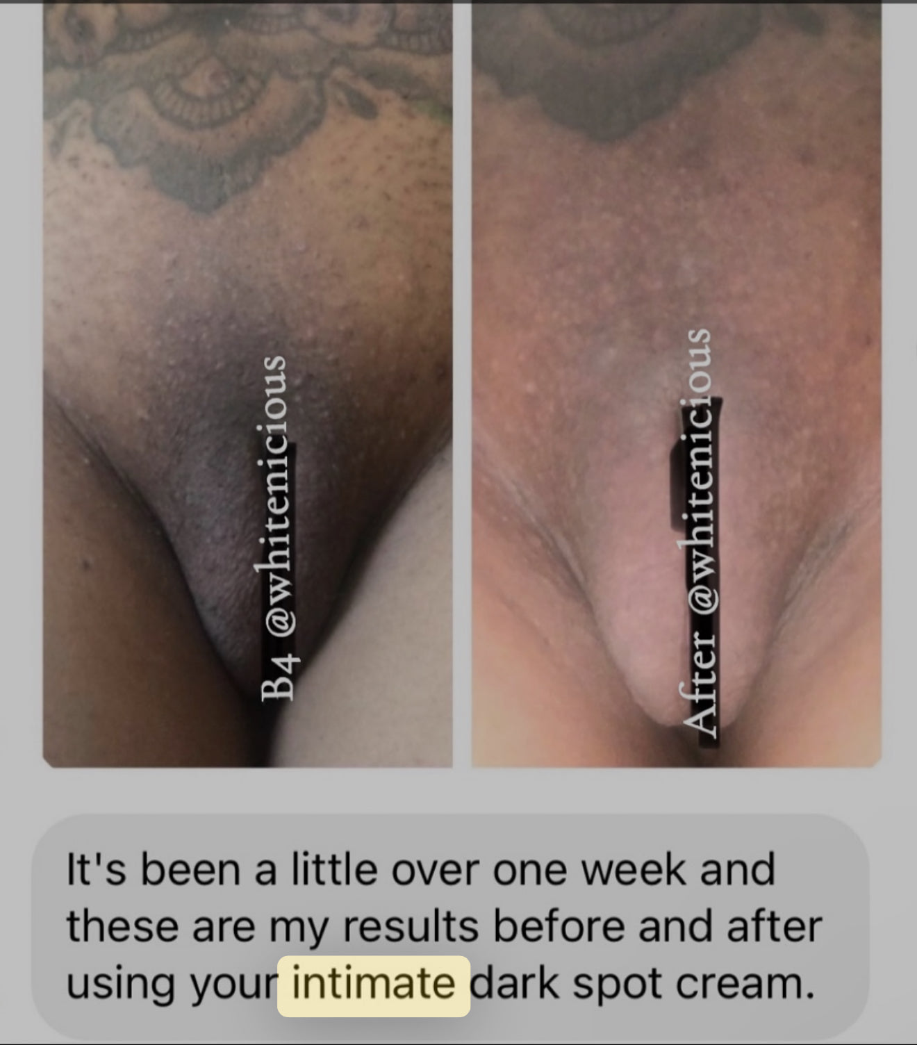 Intimate Area Cream 100Ml