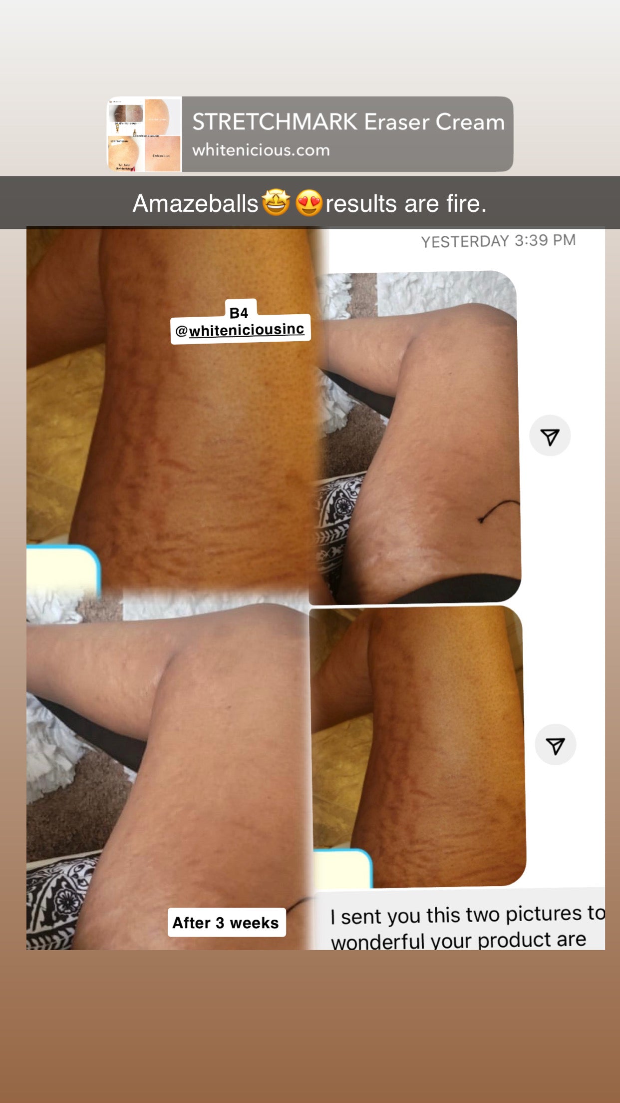 Intensive Stretch Mark Reduction Cream