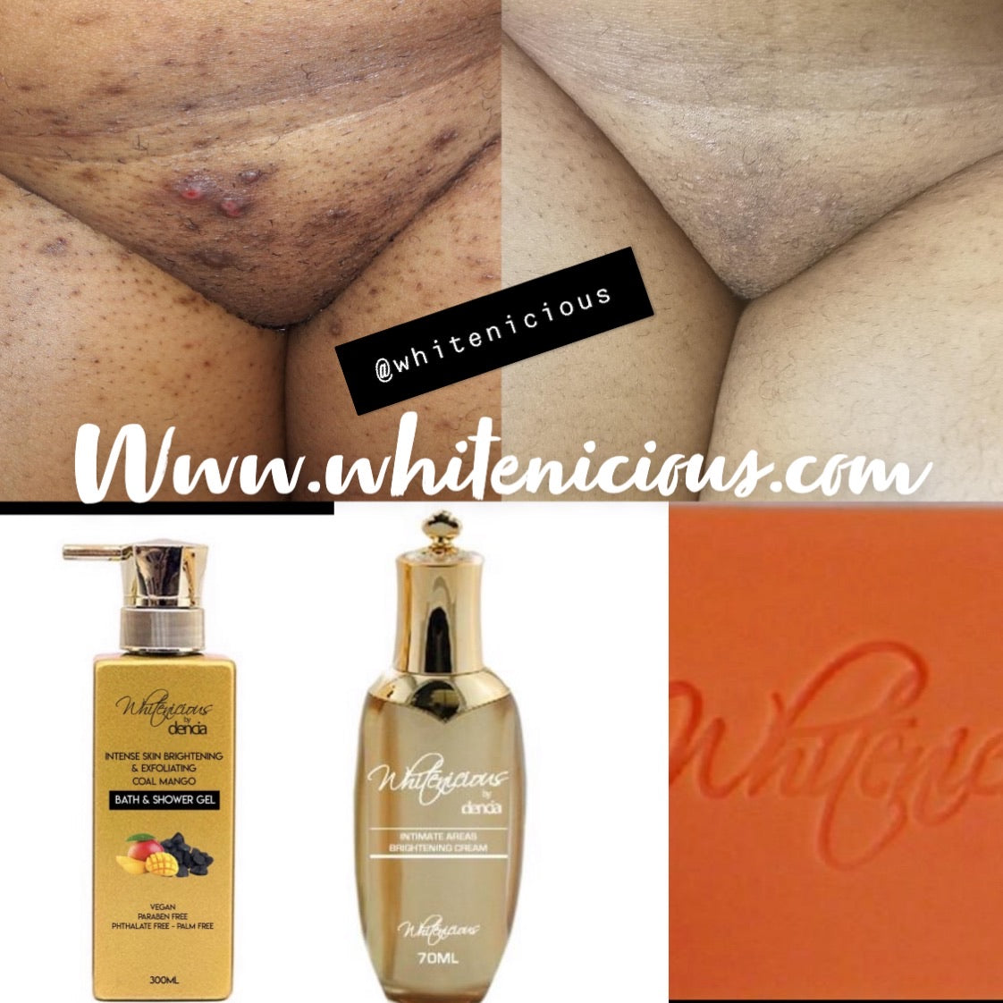 Vag Area Brightening Set