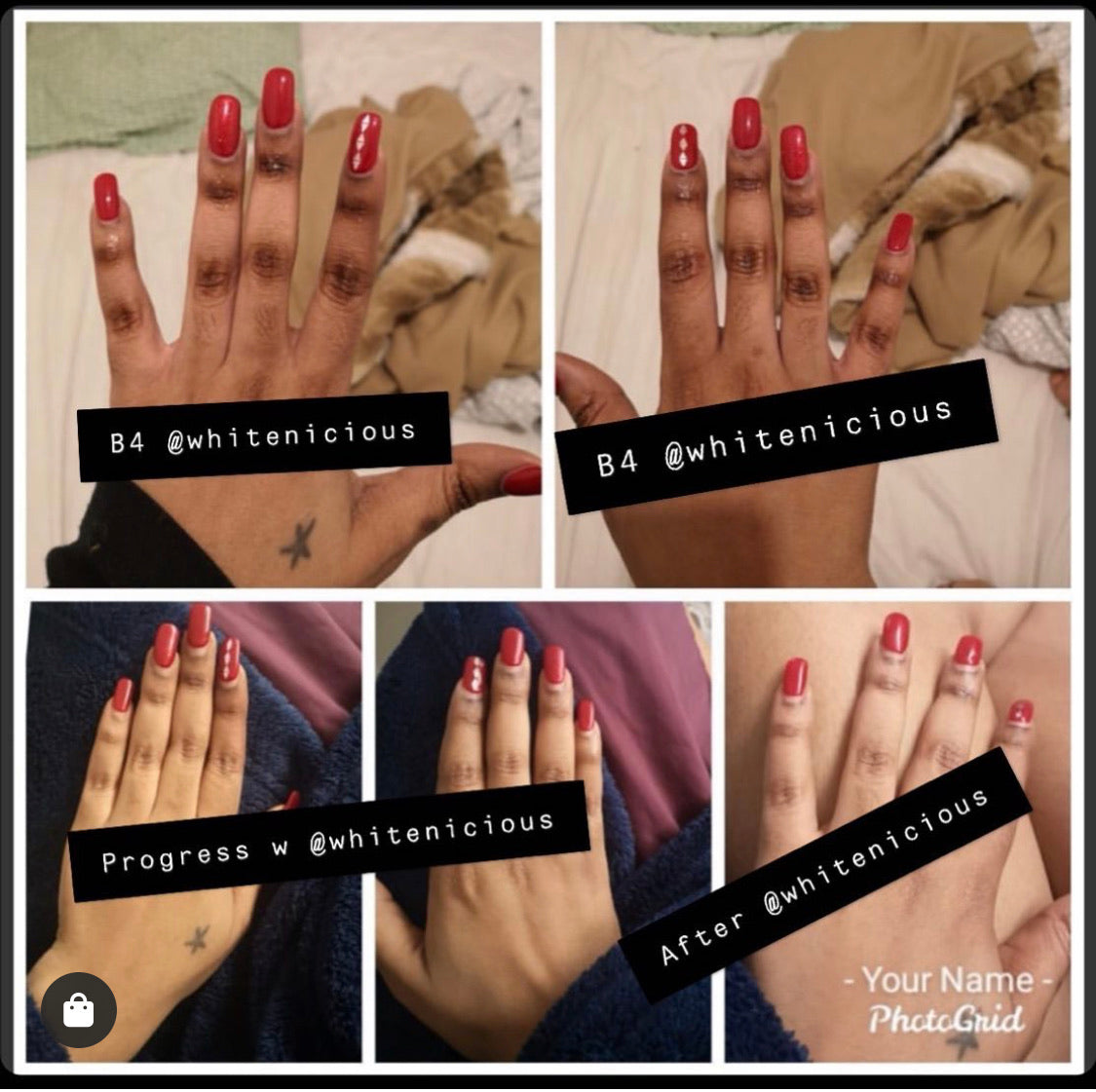 Dark Knuckles,Knees & Elbows Bleaching Cream Set.                                                                     Blac Chyna